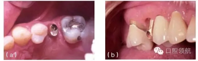 1.webp.jpg 1.webp.jpg