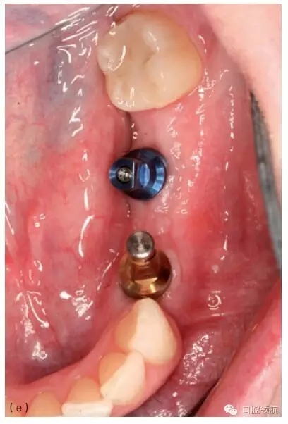 4.webp.jpg 4.webp.jpg