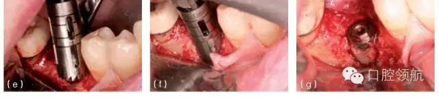 11.webp.jpg 11.webp.jpg