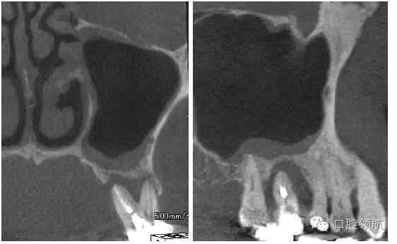 2.webp.jpg 2.webp.jpg