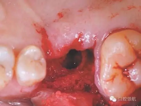 5.webp.jpg 5.webp.jpg