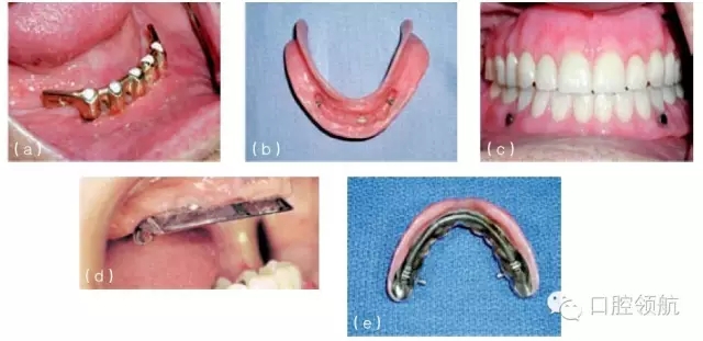 3.webp.jpg 3.webp.jpg