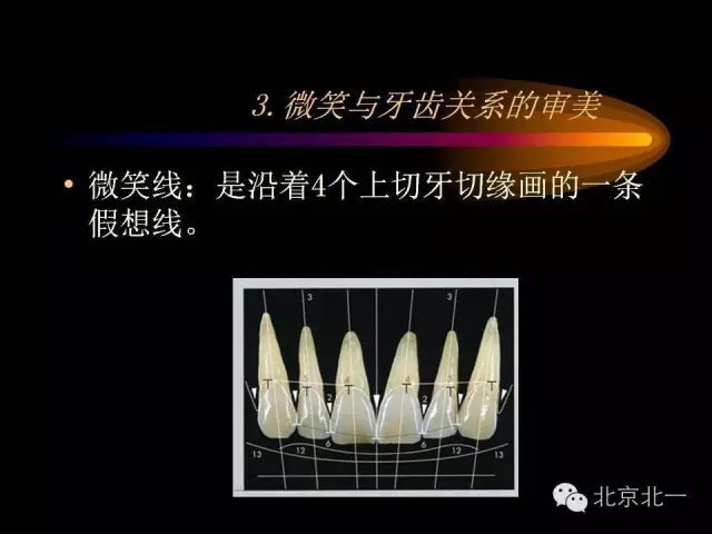 20.webp.jpg 20.webp.jpg