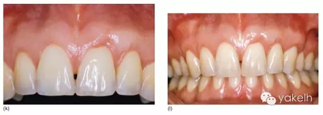 4.webp.jpg 4.webp.jpg