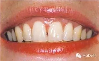 5.webp.jpg 5.webp.jpg