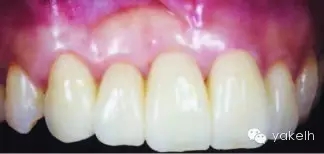 13.webp.jpg 13.webp.jpg