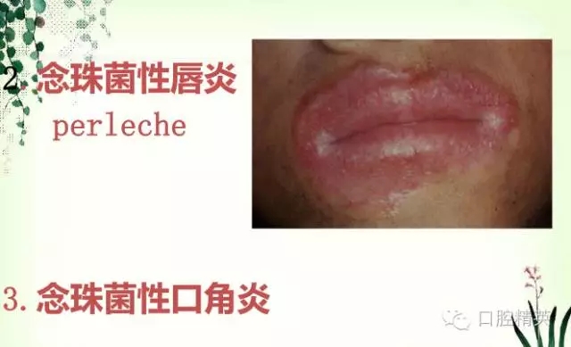 14.webp.jpg 14.webp.jpg