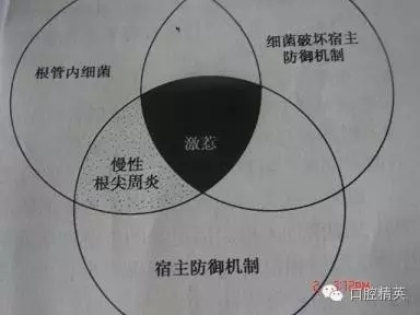 關(guān)于根管治療過程中的“激惹”現(xiàn)象 關(guān)于根管治療過程中的“激惹”現(xiàn)象