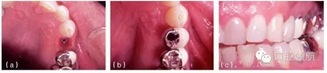 12.webp.jpg 12.webp.jpg