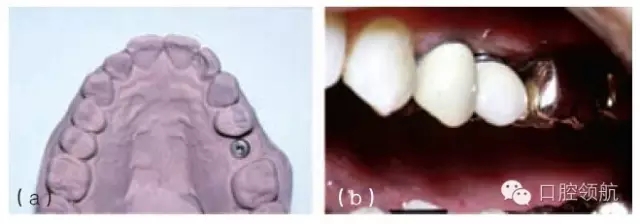 13.webp.jpg 13.webp.jpg