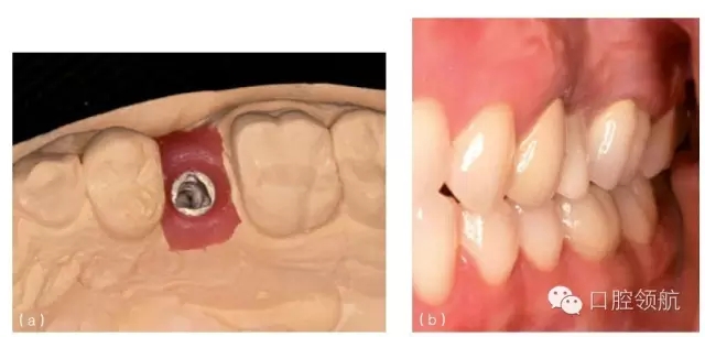 14.webp.jpg 14.webp.jpg