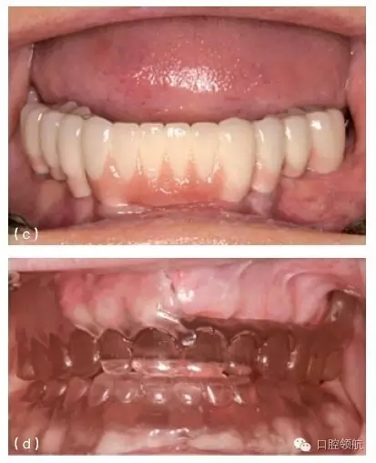 20.webp.jpg 20.webp.jpg