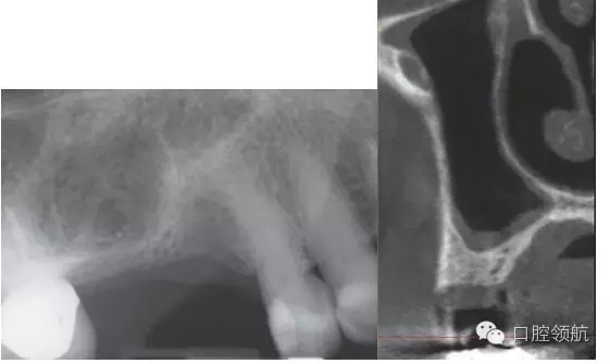 2.webp.jpg 2.webp.jpg