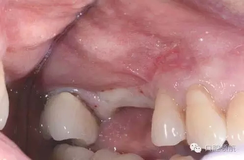 3.webp.jpg 3.webp.jpg