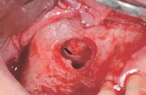 5.webp.jpg 5.webp.jpg