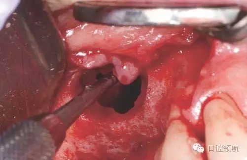 6.webp.jpg 6.webp.jpg