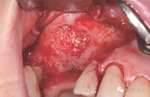 9.webp.jpg 9.webp.jpg