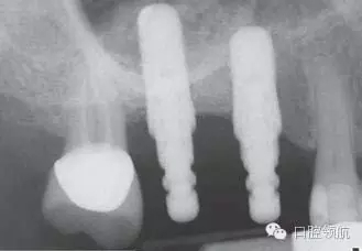 11.webp.jpg 11.webp.jpg