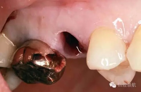 3.webp.jpg 3.webp.jpg