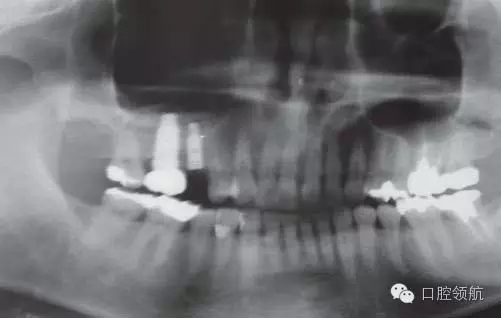 8.webp.jpg 8.webp.jpg