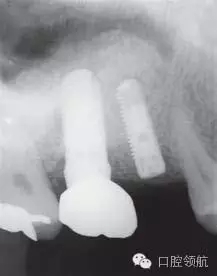 9.webp.jpg 9.webp.jpg