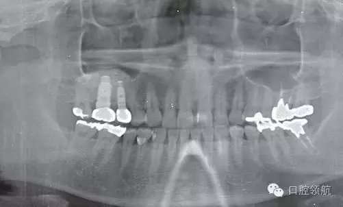 10.webp.jpg 10.webp.jpg