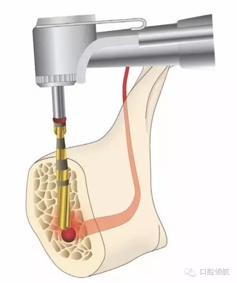 5.webp.jpg 5.webp.jpg