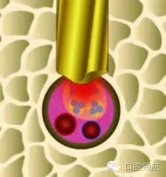 6.webp.jpg 6.webp.jpg