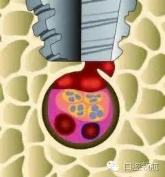 7.webp.jpg 7.webp.jpg