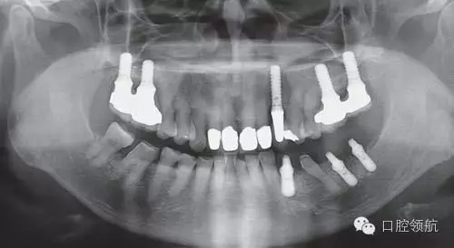 5.webp.jpg 5.webp.jpg