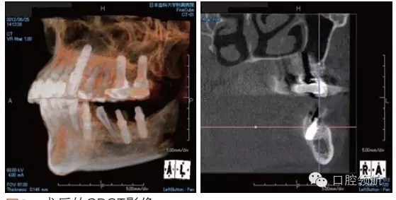 6.webp.jpg 6.webp.jpg