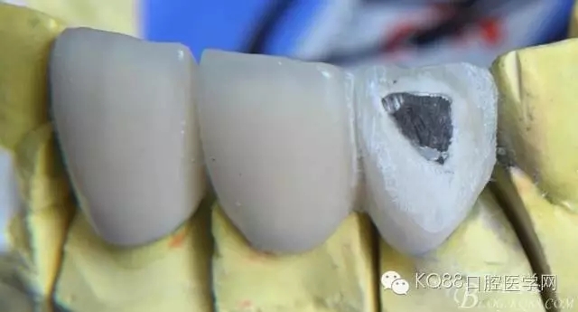 5.webp.jpg 5.webp.jpg