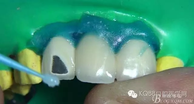 17.webp.jpg 17.webp.jpg