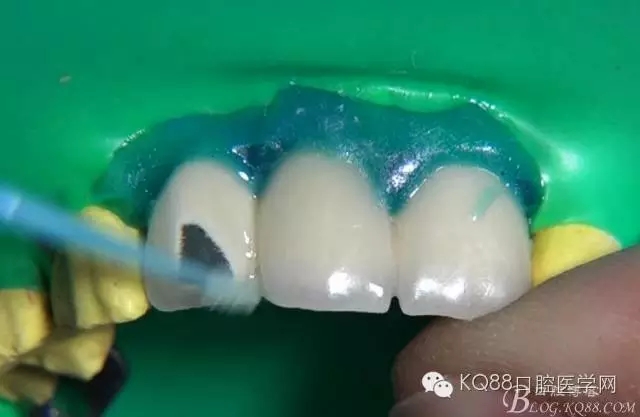 19.webp.jpg 19.webp.jpg