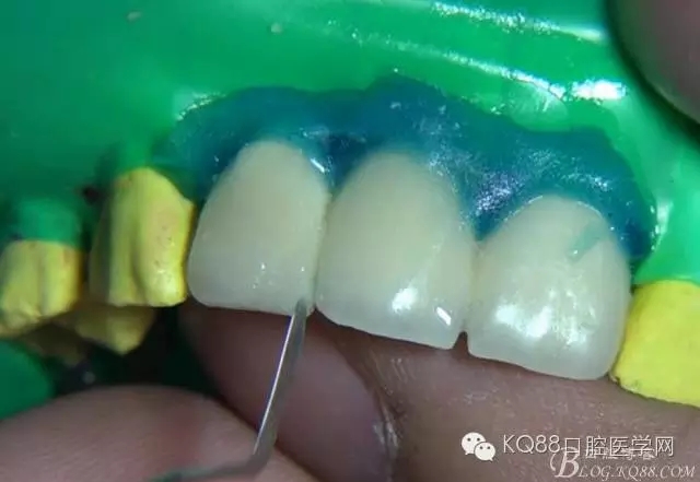 25.webp.jpg 25.webp.jpg