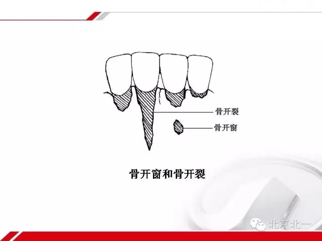 640.webp (16).jpg 640.webp (16).jpg