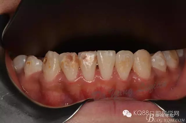 640.webp.jpg 640.webp.jpg