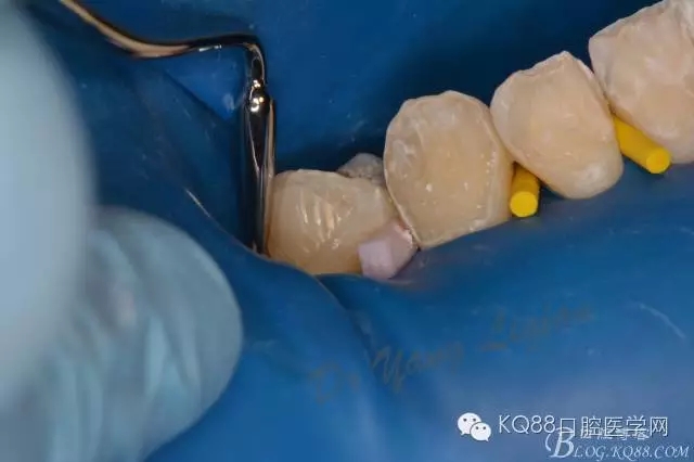 640.webp (3).jpg 640.webp (3).jpg