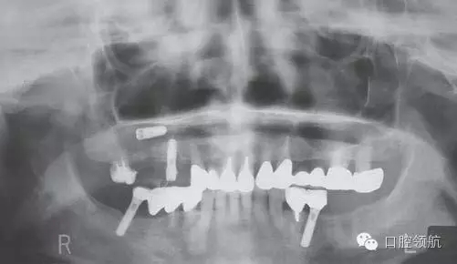 640.webp (1).jpg 640.webp (1).jpg