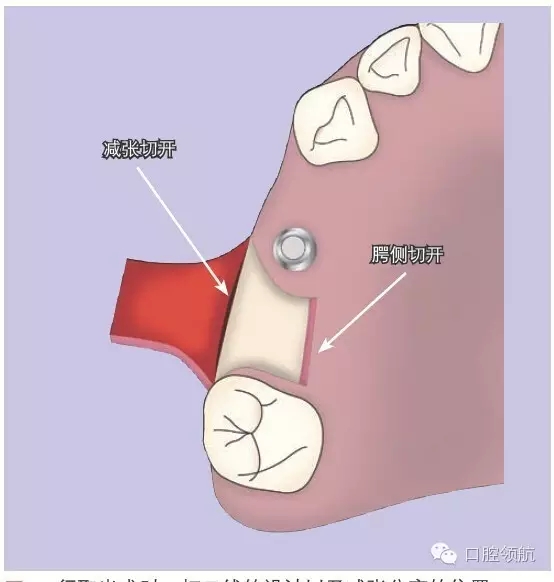 640.webp (3).jpg 640.webp (3).jpg