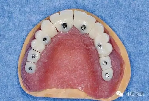 640.webp (4).jpg 640.webp (4).jpg