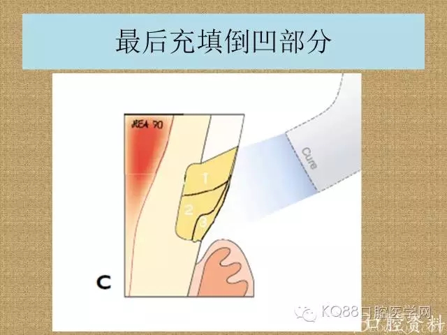 640.webp (17).jpg 640.webp (17).jpg