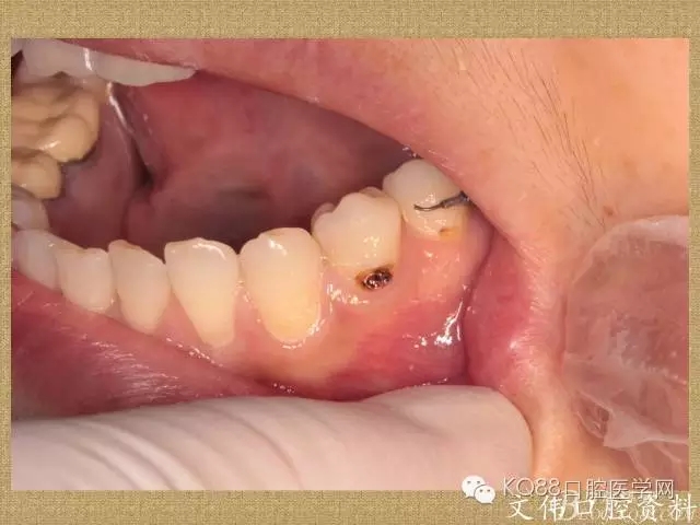 640.webp (34).jpg 640.webp (34).jpg