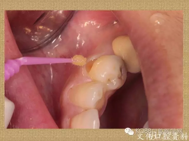 640.webp (36).jpg 640.webp (36).jpg