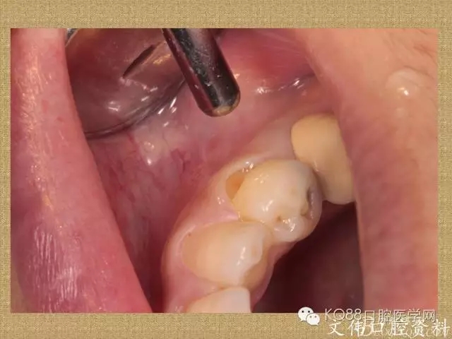 640.webp (37).jpg 640.webp (37).jpg