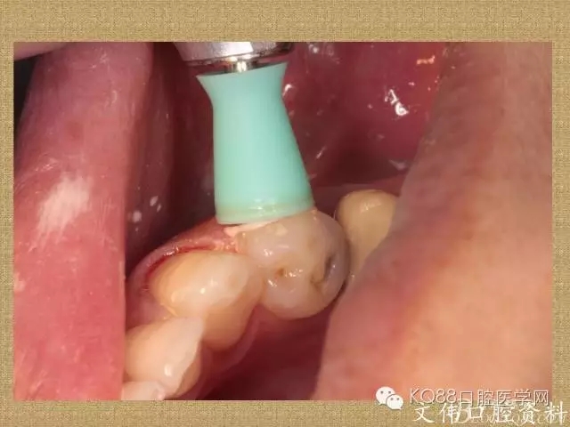 640.webp (39).jpg 640.webp (39).jpg