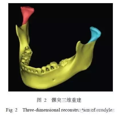640.webp.jpg 640.webp.jpg