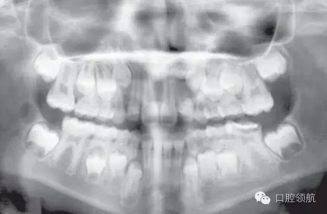 640.webp.jpg 640.webp.jpg