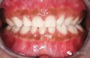 640.webp (6).jpg 640.webp (6).jpg