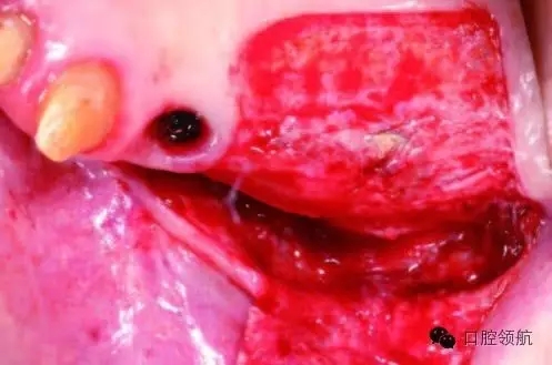 640.webp (3).jpg 640.webp (3).jpg